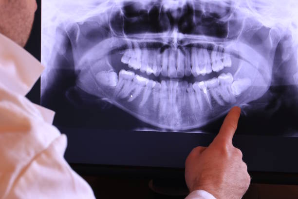 Best Emergency Dentist for Knocked-Out Tooth in Tonganoxie, KS